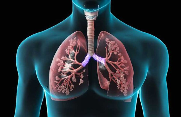 Internações por doenças respiratórias aumentam quase 28%